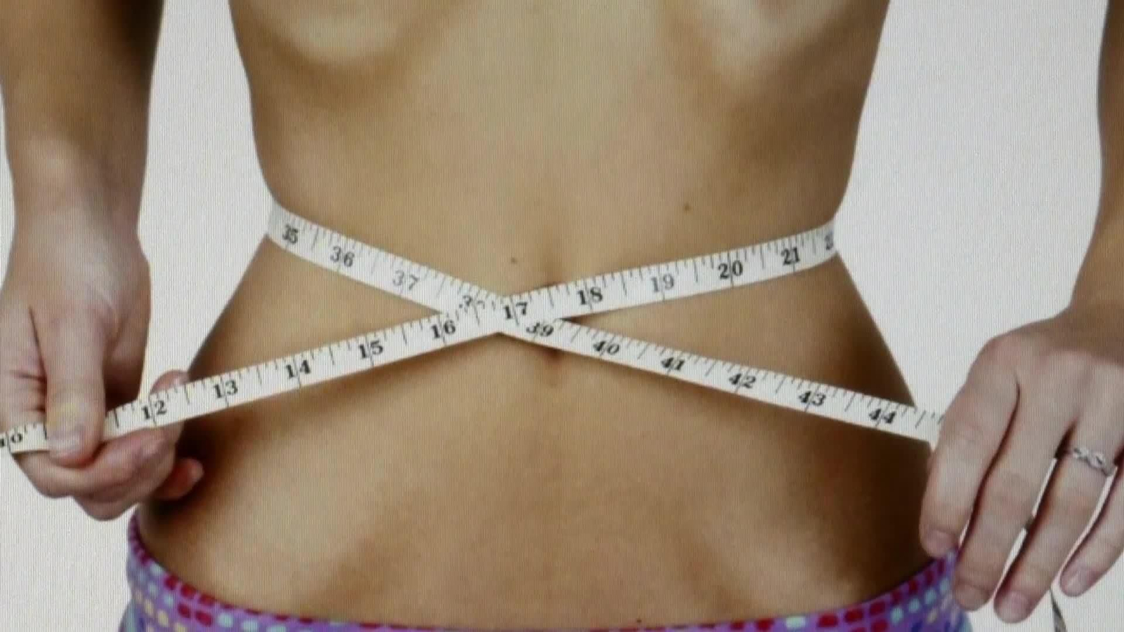 web trastornos alimentarios