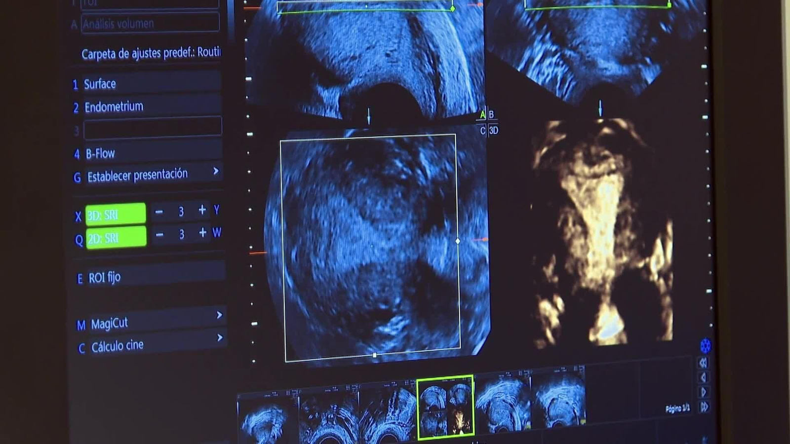 web reproduccion asistida