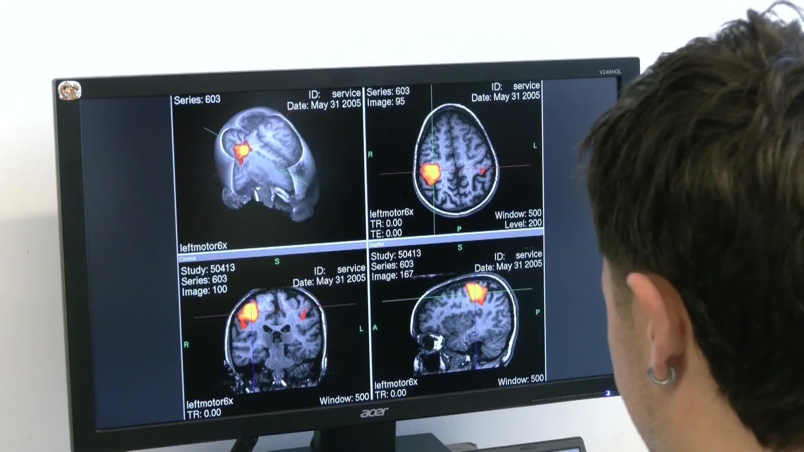 web repercusiones agresiones mujeres