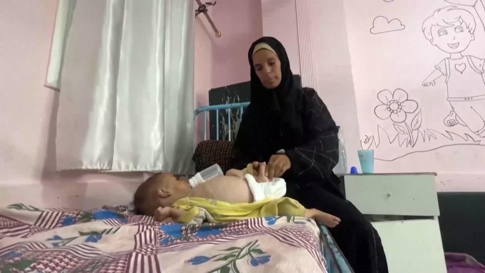 M065-GAZA MALNUTRICION NIÑOS