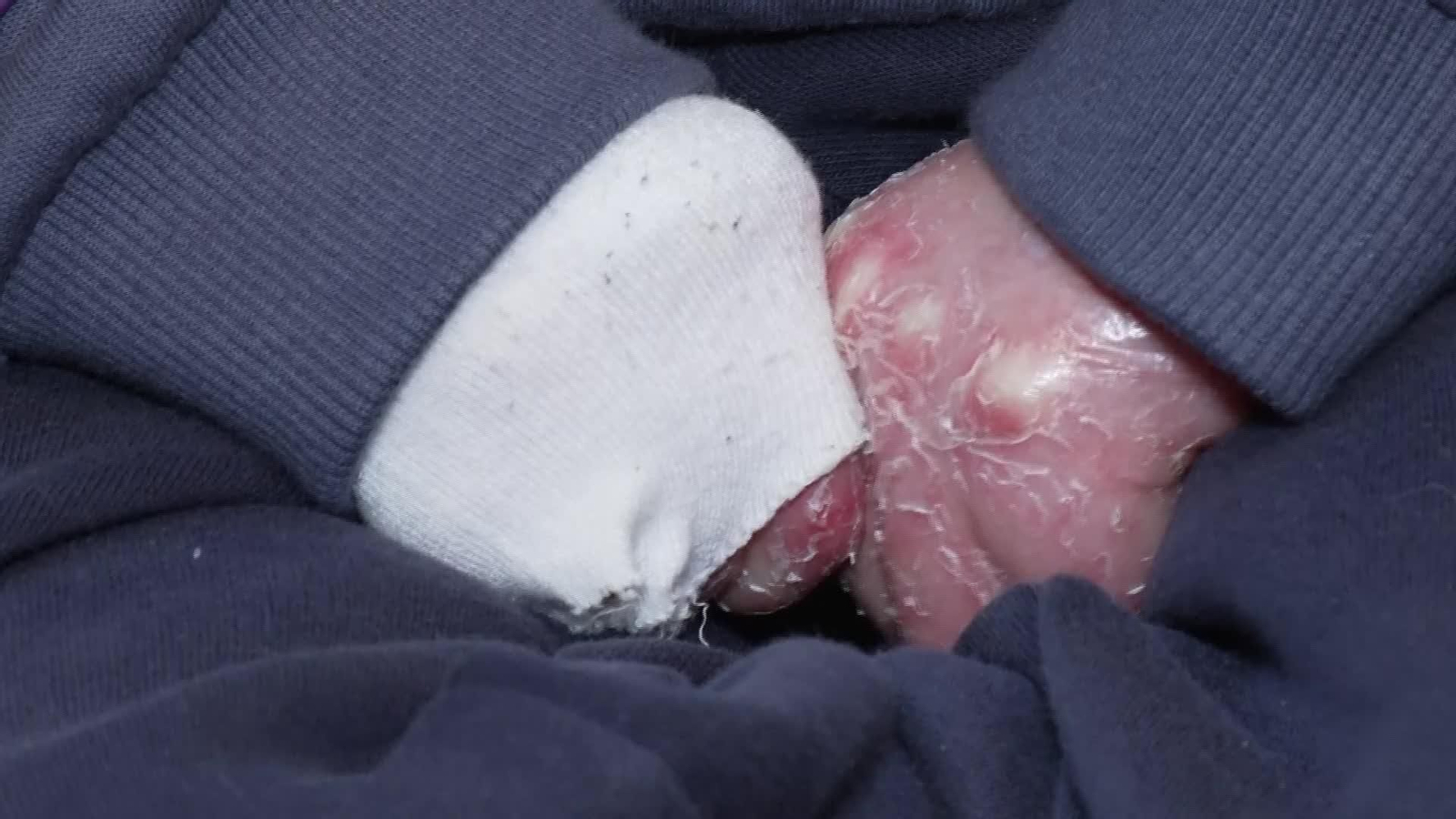 M003-EDI-SEVILLA NIÑO PIEL MARIPOSA