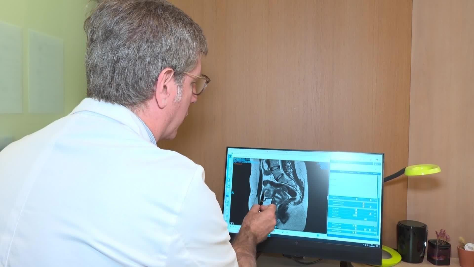 Endometriosis, una enfermedad que afecta a mas del 10 por ciento de las mujeres en la etapa reproductiva