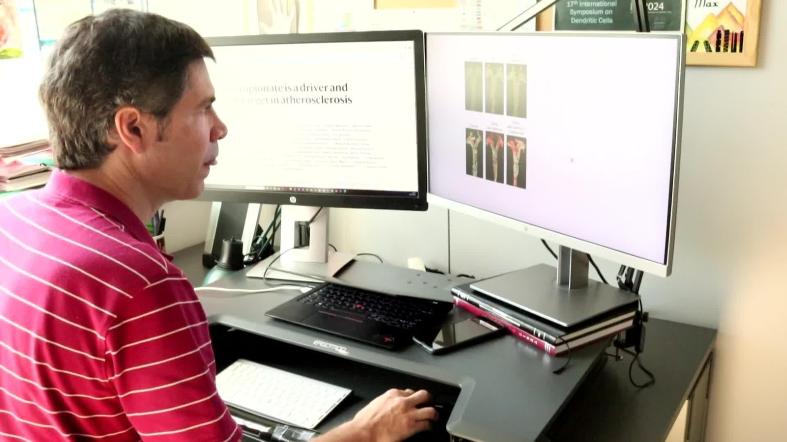 Descubren que las bacterias del intestino producen una molécula que causa aterosclerosis