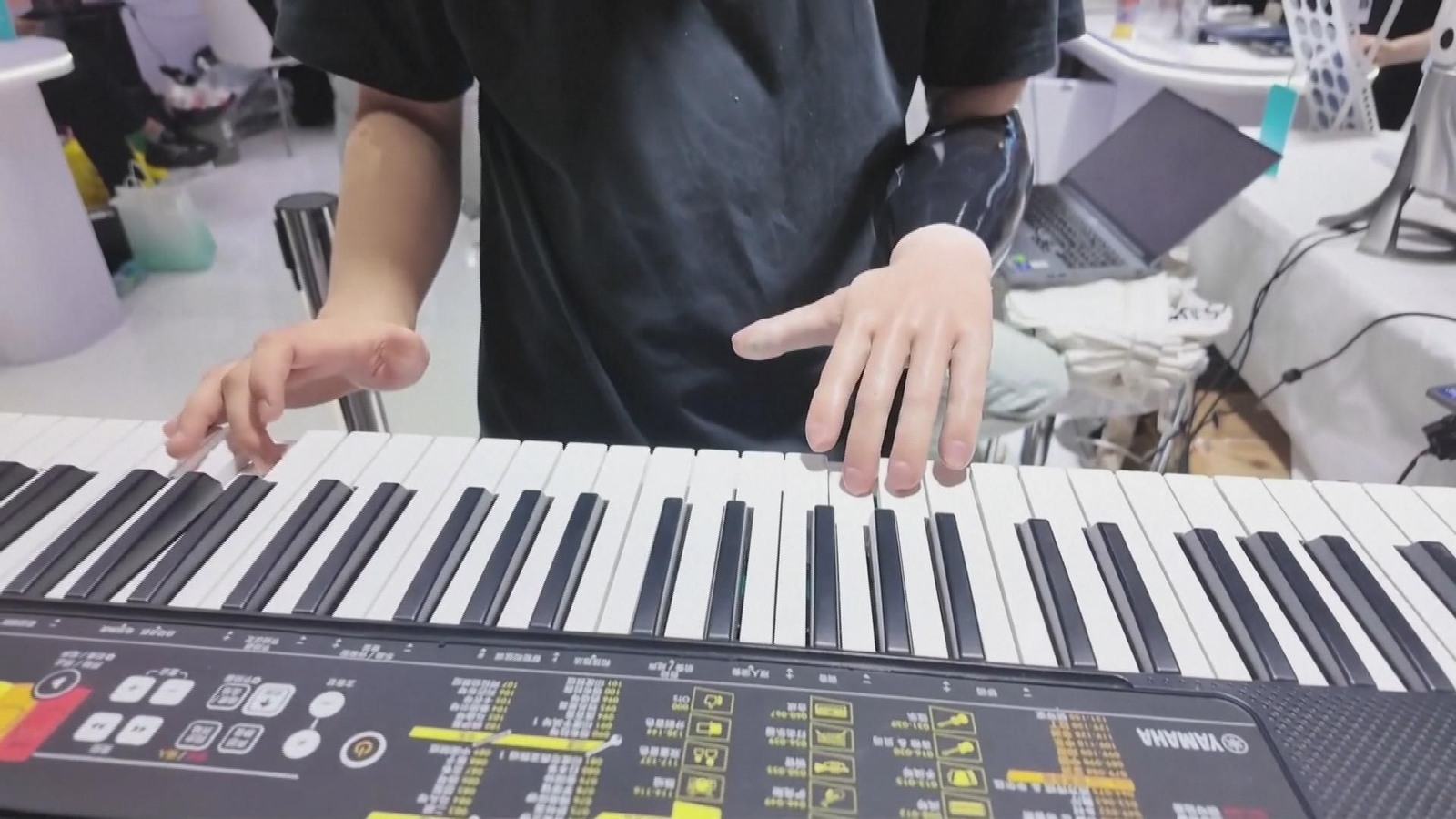Una mano biónica controlada por señales nerviosas permite tocar el piano a personas con amputaciones