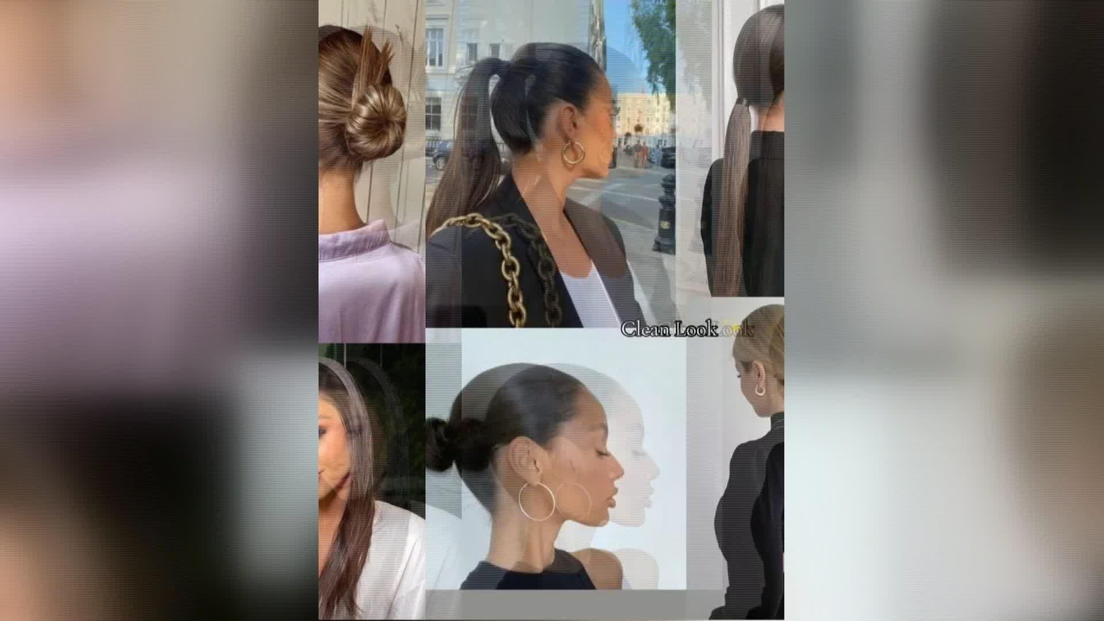 X002-EDI VARIOS ALOPECIA ADOLESCENTE REDES