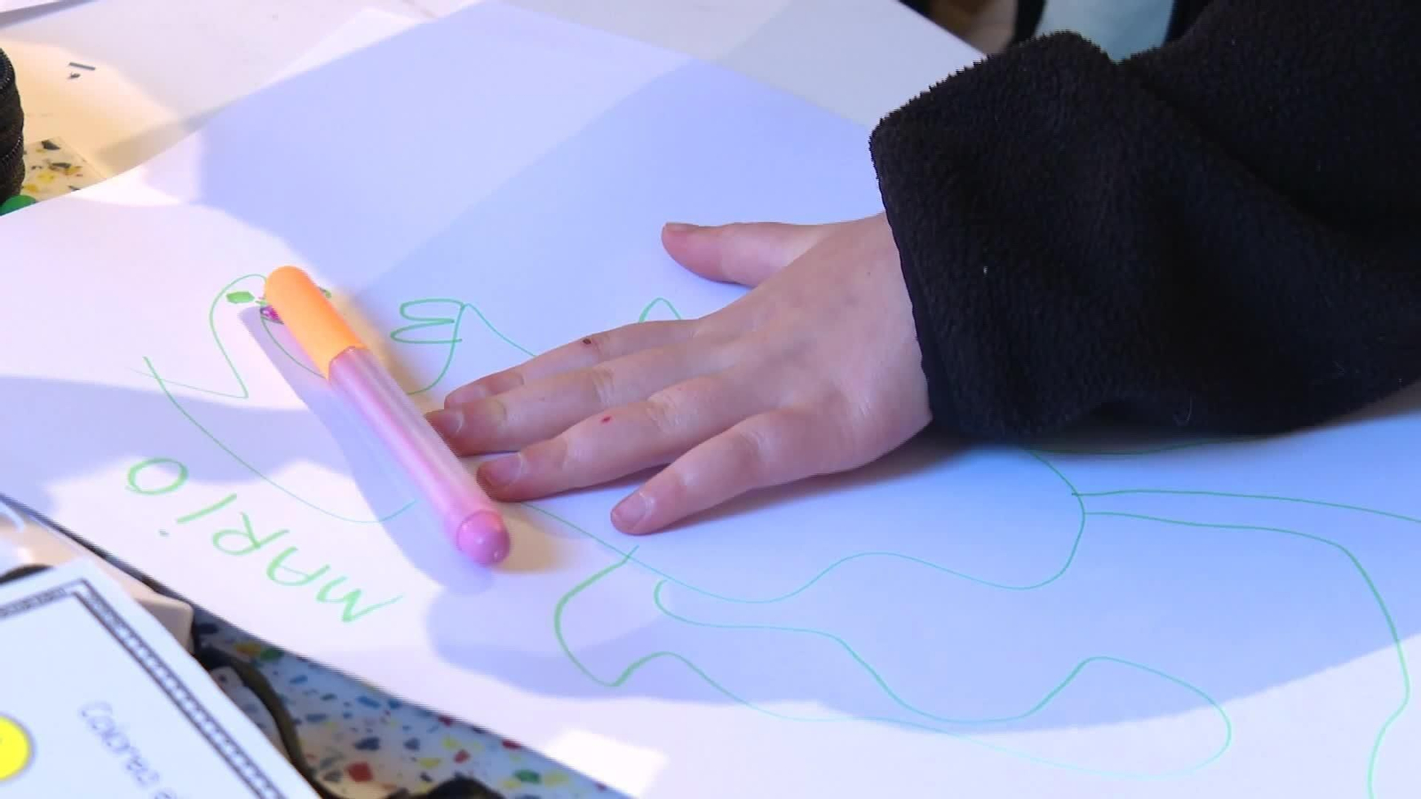 M034-BARCELONA NIÑO SINDROME RASMUSSEN