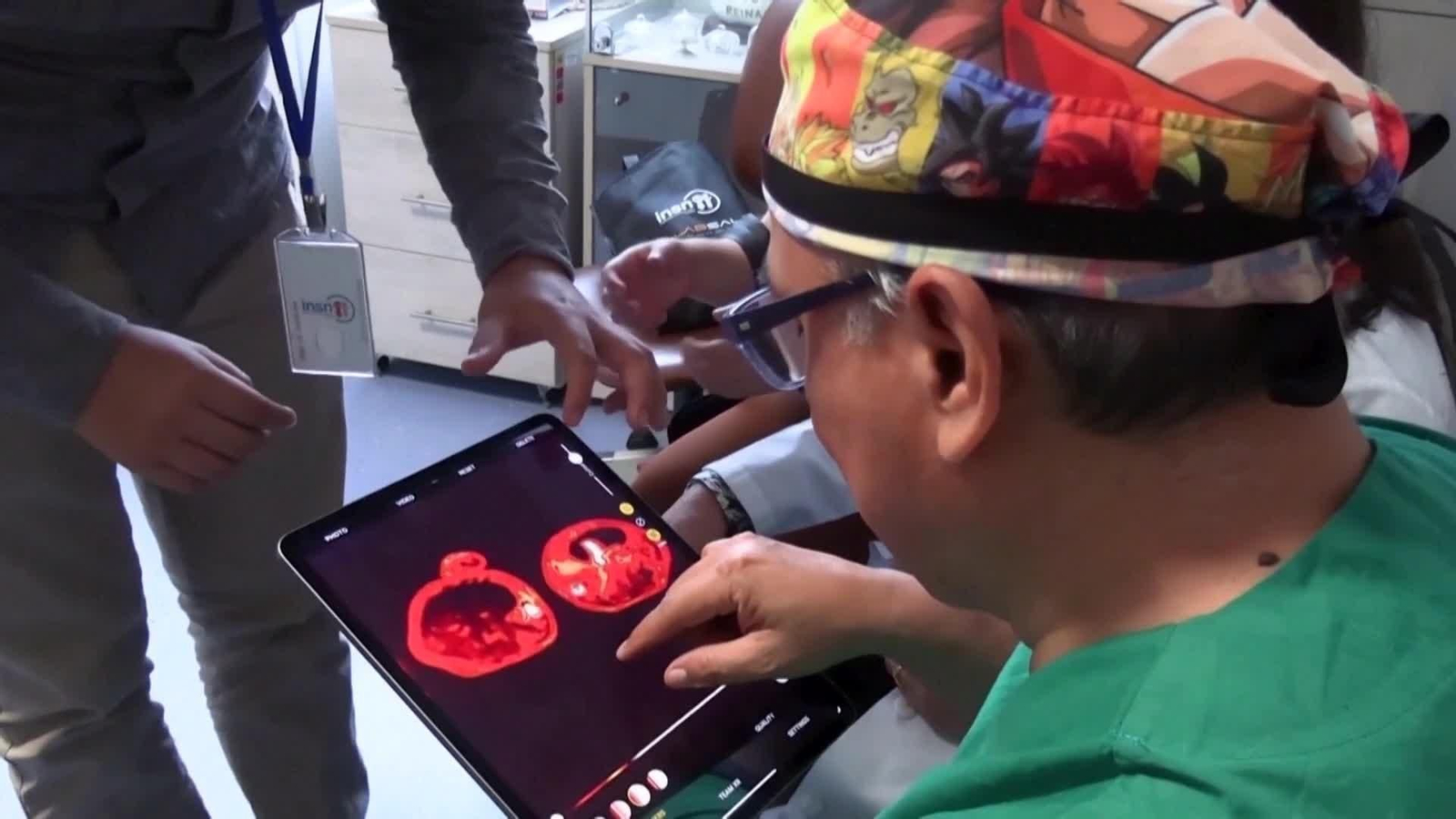 va peru operacion siamesas