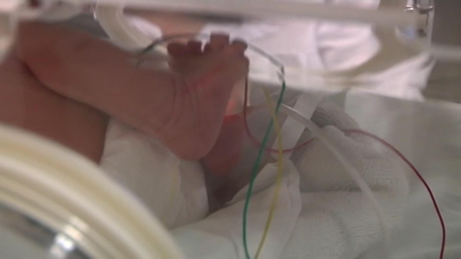 Una innovadora técnica de trasplante parcial de corazón podría salvar la vida a muchos bebés