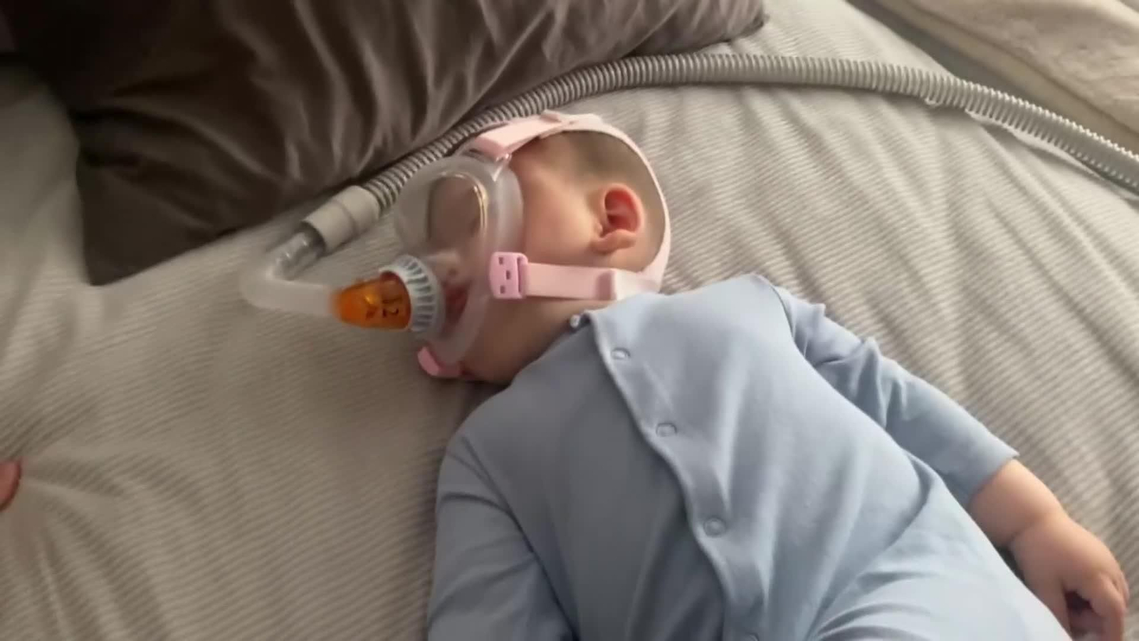 web sindrome ondine ok