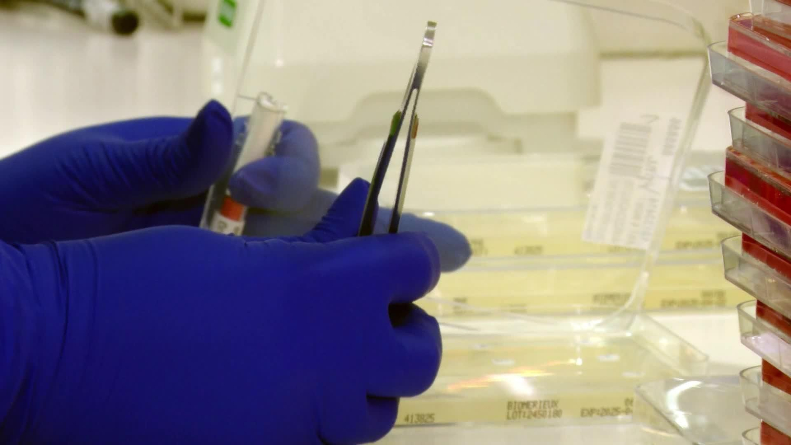 J077-EDI MADRID MICROBIOTA