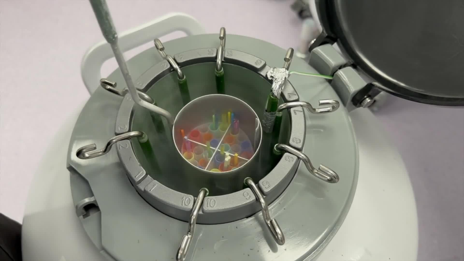 El donante de semen con un gen cancerígeno revela lagunas en el sistema de donación