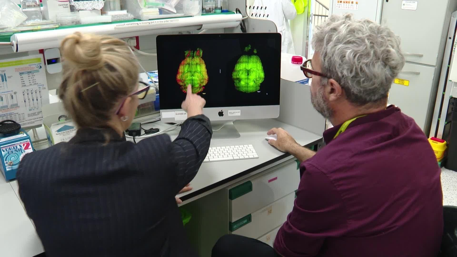 web avance alzheimer