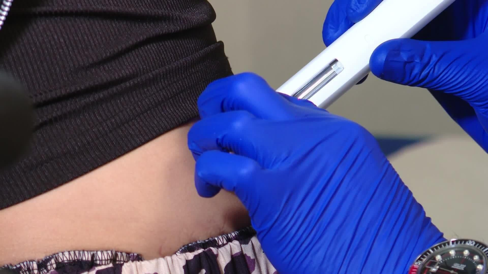 X079-EDI VARIOS MIGRAÑAS Y MENORES