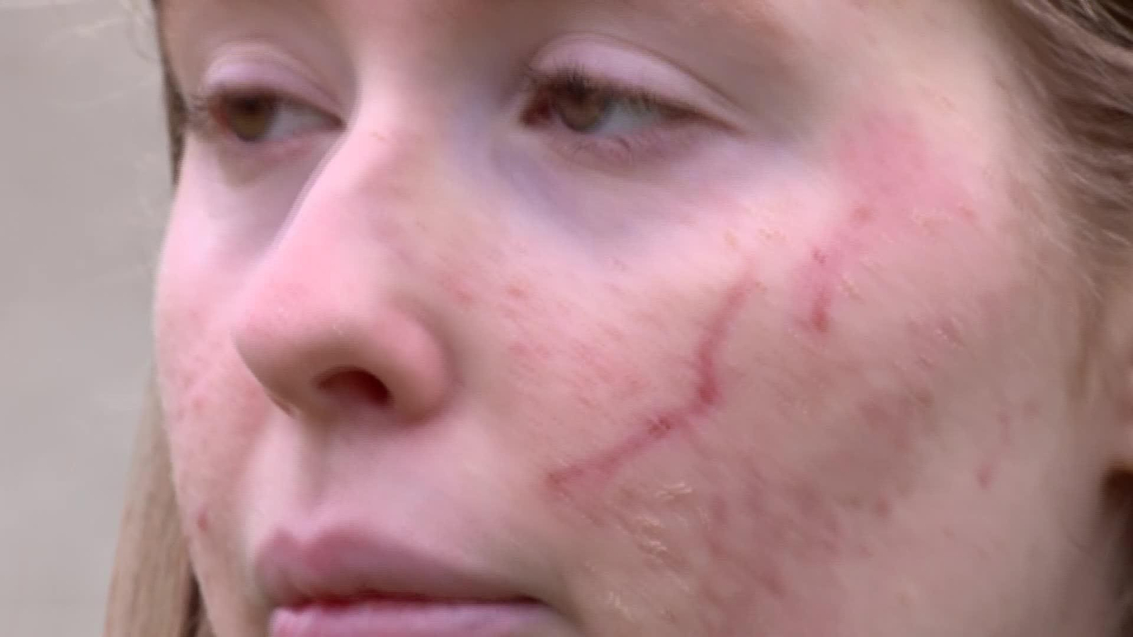 X002-EDI-PONTEVEDRA SUPERVIVIENTE ACCIDENTE COCHE