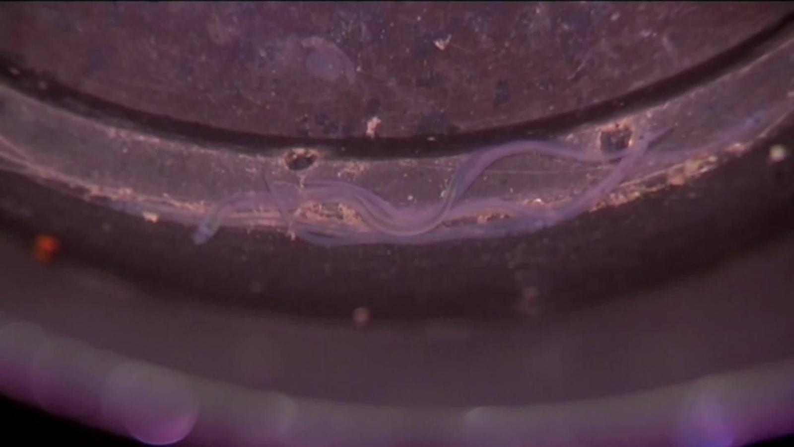 L010-EDI BILBAO ANGULEROS PROTESTA VEDA