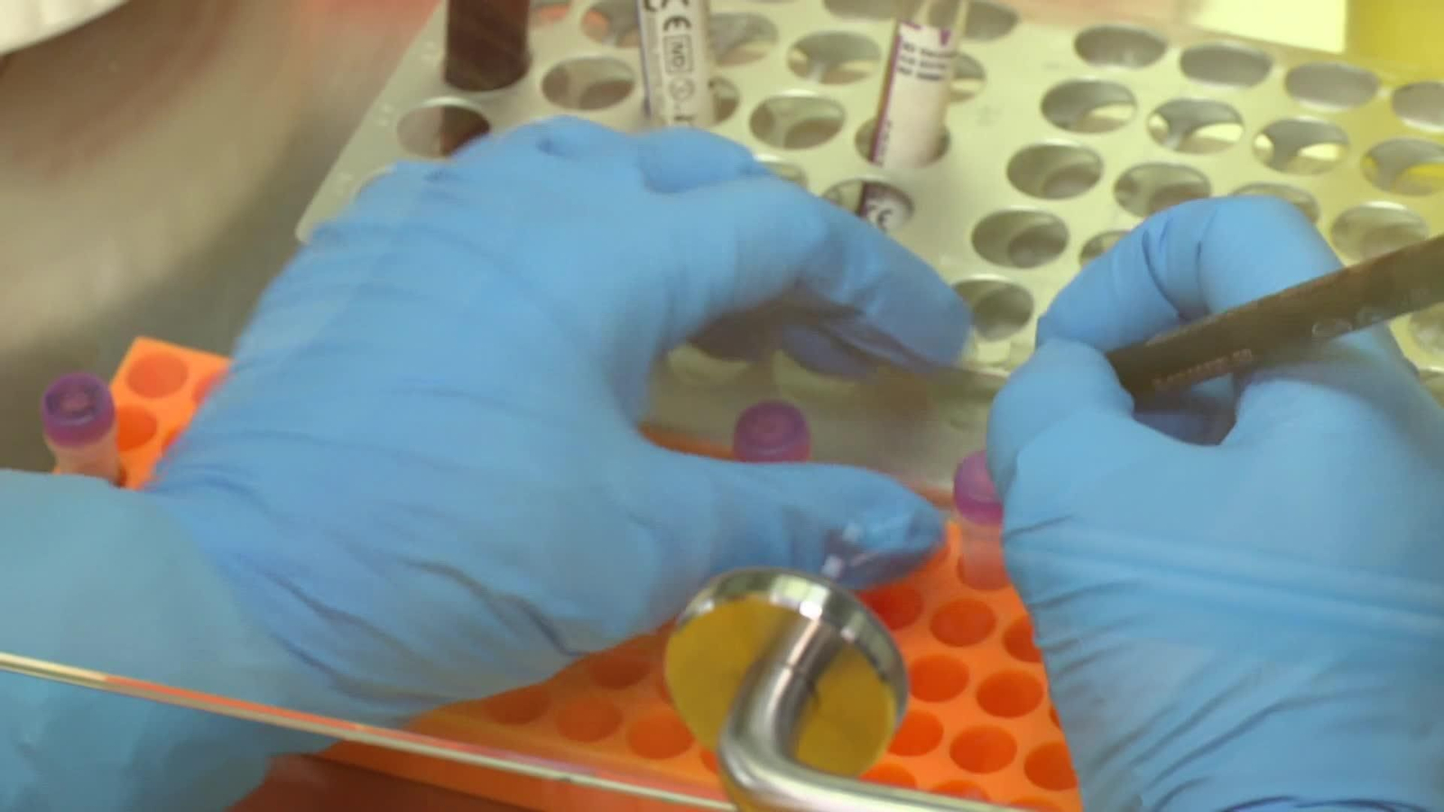 web analisis de pcr ok